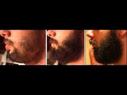 How to apply liquid minoxidil for beard. Pin On Beard N Stubble