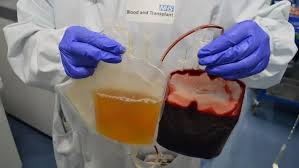 Image result for Plasma Transfusion