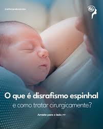 Você sabia que malformações na coluna podem ser identificadas ao nascer? O  disrafismo espinhal exige atenção cirúrgica especializada para proteger o  futuro neurológico da criança. 👉 Passe para o lado e entenda