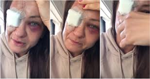 Jessica andrade knocks out karolina kowalkiewicz during this exchange in round 1 at ufc 228. Ufc Fighter Karolina Kowalkiewicz Shares Broken Eye Socket Picture After Brutal Kick To Face Daily Star