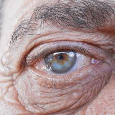 Le dr robert morse est un spécialiste sur la désintoxication des yeux qui a travaillé sur 250 000 patients. D Ou Vient La Couleur Des Yeux Vision Direct