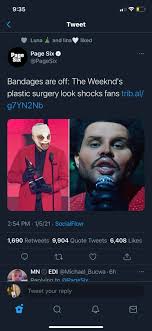 Our surgeons publish new article on tummy tuck after weight loss surgery. People Really Out Here Thinking He Actually Got Plastic Surgery Look At The Replies Theweeknd