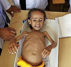 Das trifft vor allem die kinder hart. Schwierige Suche Nach Frieden Fur Den Jemen Ausland Badische Zeitung