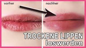 Hausmittel Gegen Brennende Und Trockene Lippen Hausfrauentipps De