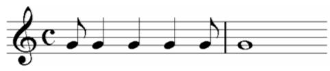 Die synkope ist ausdruck einer. Synkope Musik