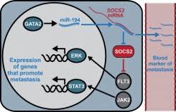 Some common signs of metastatic cancer include: Predicting And Preventing Prostate Cancer Spread