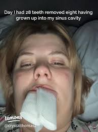 Niece's Dental Surgery Experience: A Journey Through Family Care