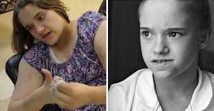 Dad Adopted 'Girl in the Window' and Changed Her Life, despite Being Warned  to Leave Her