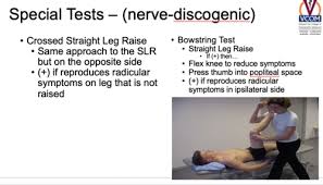 Image result for Crossed-Leg Test