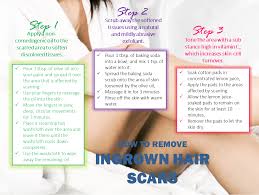 The infection appears as a very red bump filled with pus and extremely painful. Pin On Beauty Tips