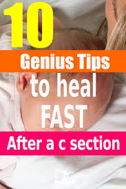 Recovering From A C Section Speeding Up Healing After A Cesarean Section C Section Cesarean Section Healing