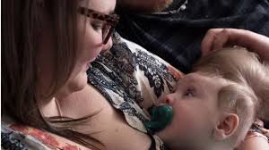 Bentley, el "bebé milagro" que logró sobrevivir con el cerebro fuera del  cráneo