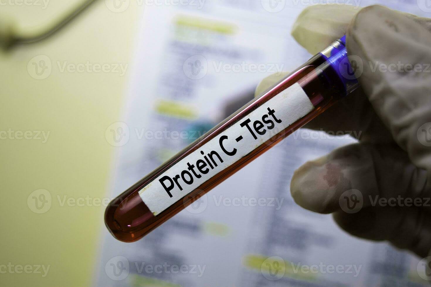 PROTEIN TOTAL product image