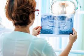 Maybe you would like to learn more about one of these? Tooth Extraction Cost How Much Is A Dental Extraction 2021 Costa Mesa Ca California Dentistry At Its Finest