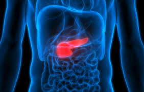These cancers are often a type of adenocarcinoma that begins in the tissue lining the gland. Real Expectations In Treating Pancreatic Cancer And The Power To Prevent It Cancer Prevention Ut Southwestern Medical Center