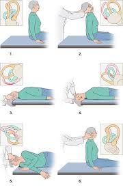 It is safe and easy to perform at home and often relieves the dizziness, spinning, and other symptoms that make vertigo so frustrating and even harmful to those at risk of falls. What Can You Do If You Have Bppv Informedhealth Org