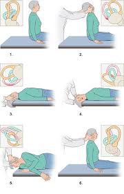 Experts say the epley maneuver may move these pieces out of your inner ear, which can help your symptoms go away.2 x trustworthy source medlineplus collection of medical information sourced. What Can You Do If You Have Bppv Informedhealth Org