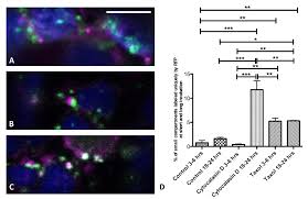 We did not find results for: Membranes Free Full Text Actin And Microtubules Differently Contribute To Vacuolar Targeting Specificity During The Export From The Er Html