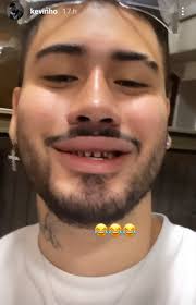 Normalmente os dentinhos começam a nascer quando o bebê deixa de mamar exclusivamente, por volta dos 6 meses, sendo um marco de desenvolvimento importante. Kevinho Mostra Dentes Sem Lente De Contato E Gera Memes Na Internet Alagoas 24 Horas Lider Em Noticias On Line De Alagoas