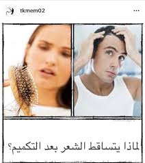 رابطة المتكممين On Twitter 5 رأي دكتور جلديه عن تساقط الشعر بعد التكميم رابطة المتكممين
