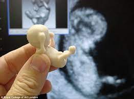 Stunning New Technology Allows Parents To Hold A Life Size Model Of Their Unborn Child 3d Printing Unborn Baby Prints