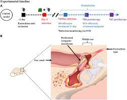 Chronic suppurative otitis media (csom) is a chronic inflammation of the middle ear and mastoid cavity that is characterised by discharge from the middle ear through a perforated tympanic membrane for at least 6 weeks. A Novel Mouse Model Of Chronic Suppurative Otitis Media And Its Use In Preclinical Antibiotic Evaluation Science Advances