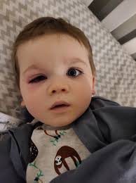 Best rattling bath toy : Mom S Viral Warning On Tub Toys After Toddler S Terrifying Infection Gma