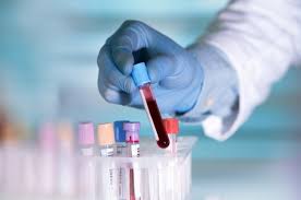 Assistencia de enfermagem em exames laboratoriais. Clinicas Que Fazem Exames Laboratoriais De Sangue Itaquera Exames De Sangue Para Homens Avante Medicina Diagnostica