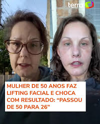 Mi Michelle Good Lifting Facial
