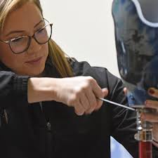 Ontario company awarded $15M federal contract to help amputees