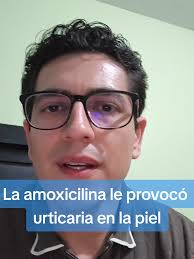 Amoxicilina Y Acido Clavulanico Efectos Secundarios