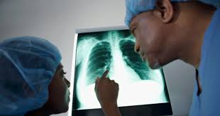 Pain Under Right Rib Cage 26 Common Causes Diagnosis And Treatment
