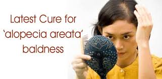Researchers at the columbia university medical center may have found a way to cure baldness.they've identified a new drugs that could stimulate rapid and robust hair growth by inhibiting a family of enzymes inside hair follicles that are suspended in a resting state, restoring hair growth.in experiments with mouse and human hair follicles, angela m christiano from columbia university medical. Latest Cure For Alopecia Areata Baldness