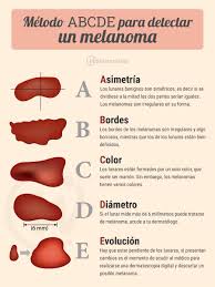 Called the abcdes of melanoma, these acronyms will help. Hosp Pediatrico Bqto On Twitter Diamundialmelanoma El Metodo Del Abcde P Detectar El Melanoma Hupaz Lara Barquisimeto