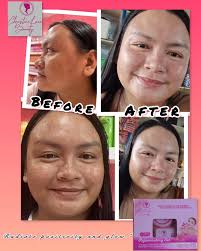 Christine luxe beauty rejuvenating set results