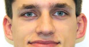 Jaren Haser column: Mother Nature taking big bite out of spring seasons