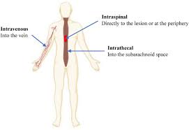 Customer service representative, executive, intern and more on indeed.com. Treatment Of Spinal Cord Injury With Mesenchymal Stem Cells Abstract Europe Pmc