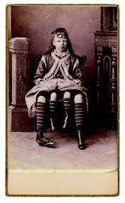 Josephine myrtle corbin was given birth to on the 12th of may, 1886, in lincoln county, tennessee as a dipygus. Josephine Myrtle Corbin Reference Photo For My Next Bjd Flickr