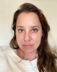 skin tightening/lines