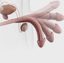 Das Solltest Du Nach Dem Sex Mit Deinem Penis Machen Welt