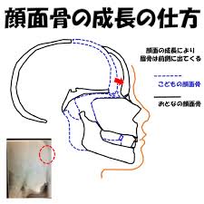 眉 骨 と は