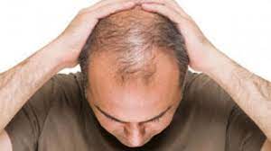 This discussion is closed to comments. Prescription Medications Associated With Hair Loss And What To Do