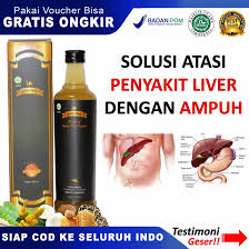 We did not find results for: M Biopro Obat Liver Kronis Ringan Suplemen Kesehatan Obat Obatan Tradisional Hepatitis A B Dan C Obat Hbsag Obat Penyakit Kuning Obat Pembengkakan Hati Obat Bengkak Hati Obat Hemangioma Obat Sirosis Hati Obat Autis Fungsi Hati
