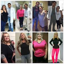 Vertical sleeve gastrectomy is not a quick fix for obesity. Bariatric Surgery Tijuana Mexico Surgeon Alo Bariatrics