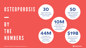 Osteoporosis Signs Symptoms Testing Treatment