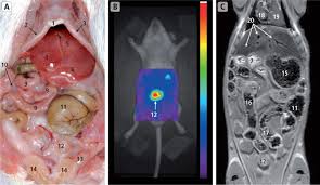 (7) once this happens kidney stones are also often associated with utis, which develop when bacteria makes its way into your kidneys, ureters, bladder, or urethra and causes an infection. Ureter An Overview Sciencedirect Topics