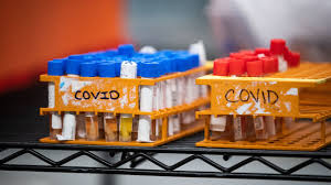 Baldyoungpussy.com has tons galleries of teen girls' holes. Dr Bonnie Henry Says The Seven Day Average Of Cases Creeping Up In Some B C Jurisdictions Ctv News