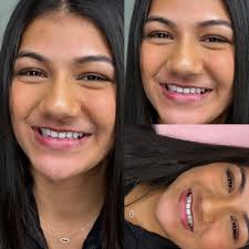 Online Trainings Available 🖥️🌏📦 We offer 2 online training packages ⬇️  1️⃣Fully equipped kit + Manual + Certificate + health and consent pdf forms  and LED Teeth whitening machine valued at $750