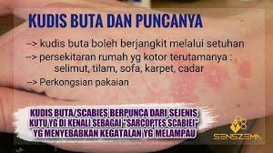 A well, blinds, scabies, sinecure, marcapada, blind spot, illiterate, maksud blind. Klinik Avicenna Apa Itu Kudis Buta Ketahui Punca Facebook