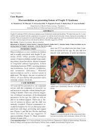 Pdf Macroorchidism As Presenting Feature Of Fragile X Syndrome